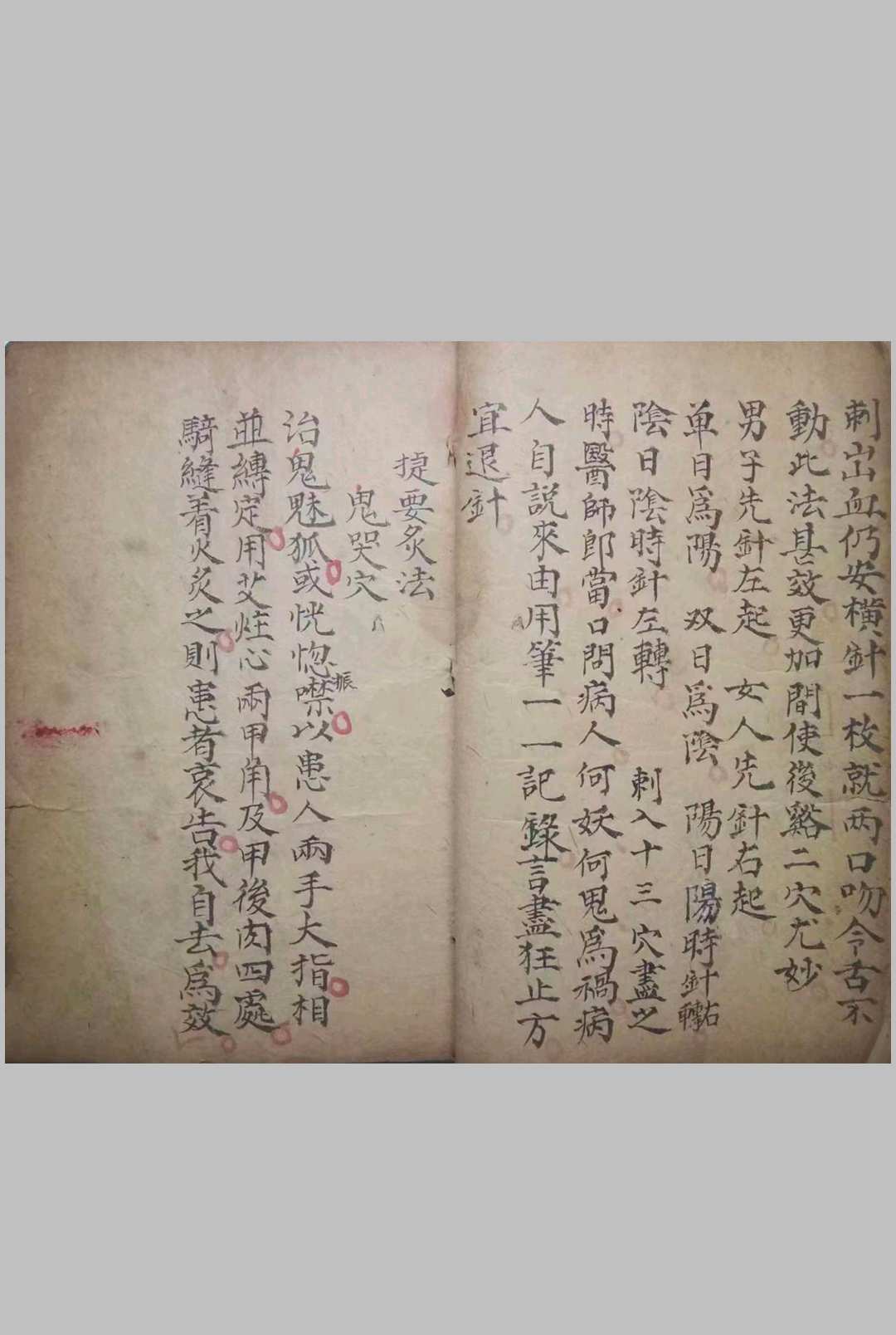 图片[2]-中华古籍网-专注古书收集孙真人十三针鬼穴 鬼门十三针-中华古籍网-专注古书收集中华古籍网-专注古书收集