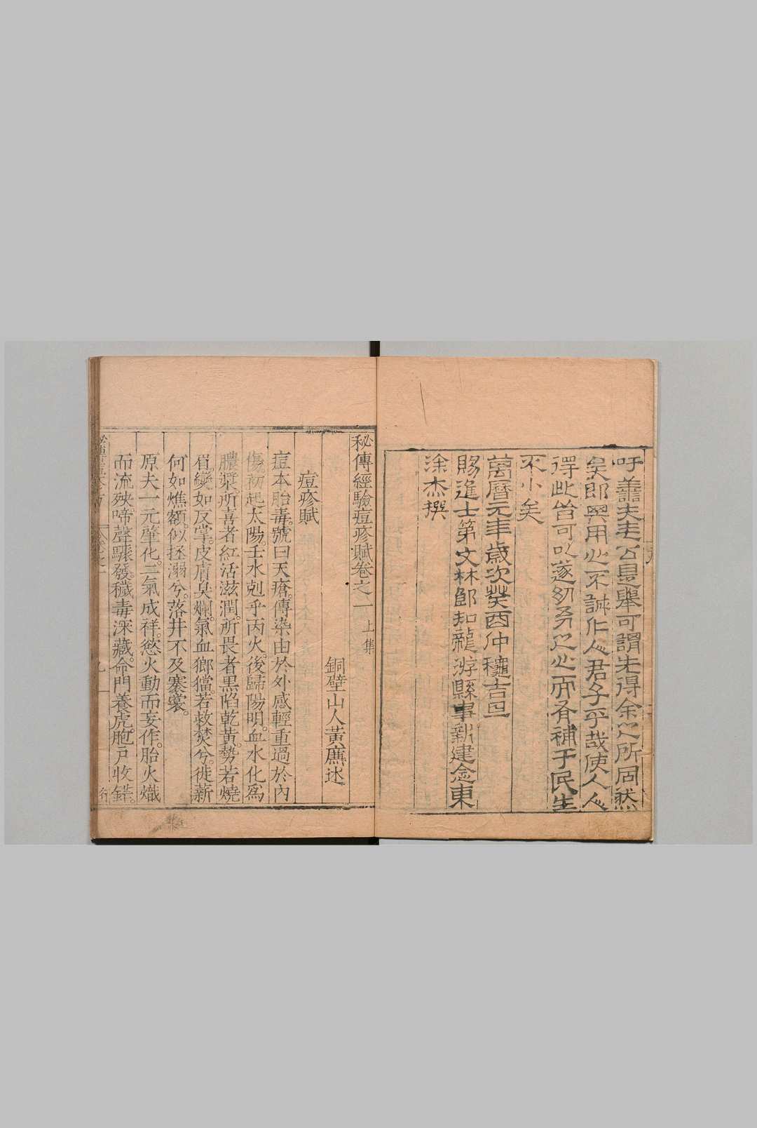 图片[3]中华古籍网-专注古书收集秘传经验痘疹方 ４卷 黄廉,明万历元年中华古籍网-专注古书收集中华古籍网