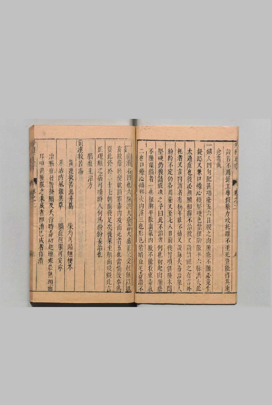 图片[9]中华古籍网-专注古书收集新刊外科正宗 陈实功  明刊本中华古籍网-专注古书收集中华古籍网