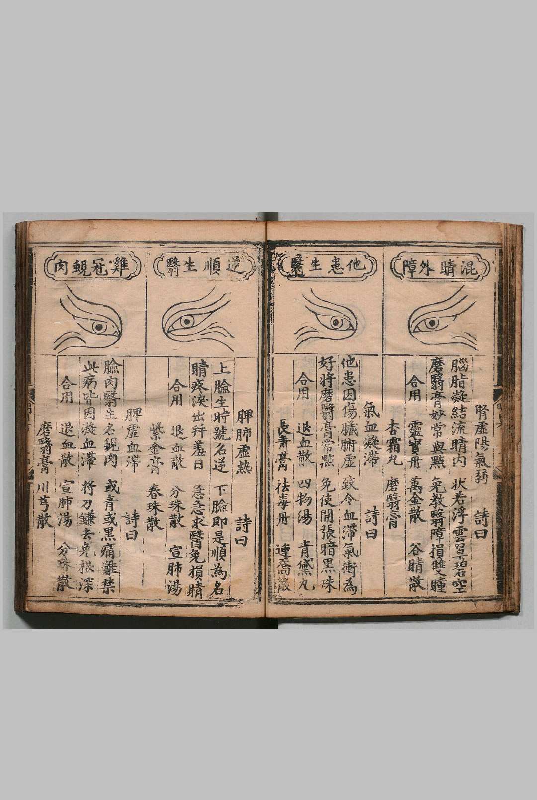 图片[9]中华古籍网-专注古书收集明目神验方 明弘治13年 , 江西等处承宣布政使司中华古籍网-专注古书收集中华古籍网