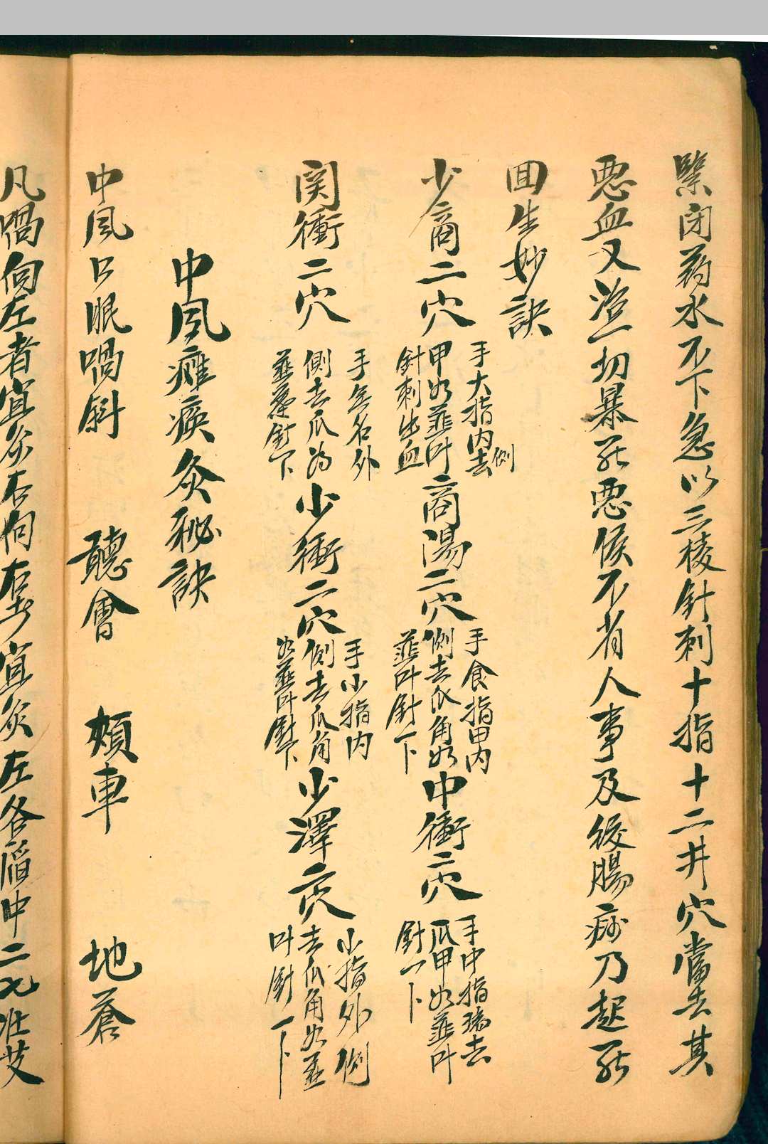 图片[5]-中华古籍网-专注古书收集针灸秘穴-中华古籍网-专注古书收集中华古籍网-专注古书收集