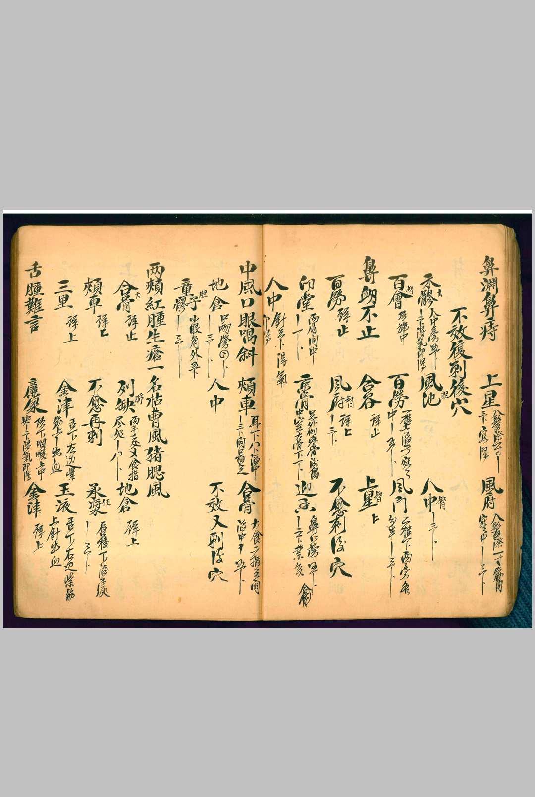 图片[11]-中华古籍网-专注古书收集针灸秘穴-中华古籍网-专注古书收集中华古籍网-专注古书收集