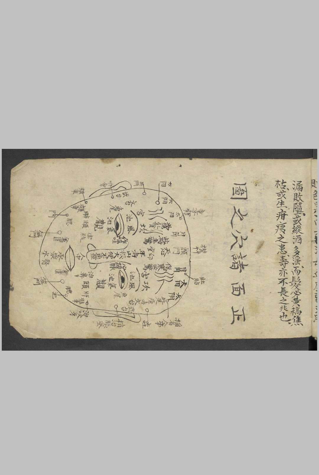 图片[10]-中华古籍网-专注古书收集熊应运 全抄小儿推拿广意 , 1900-中华古籍网-专注古书收集中华古籍网-专注古书收集