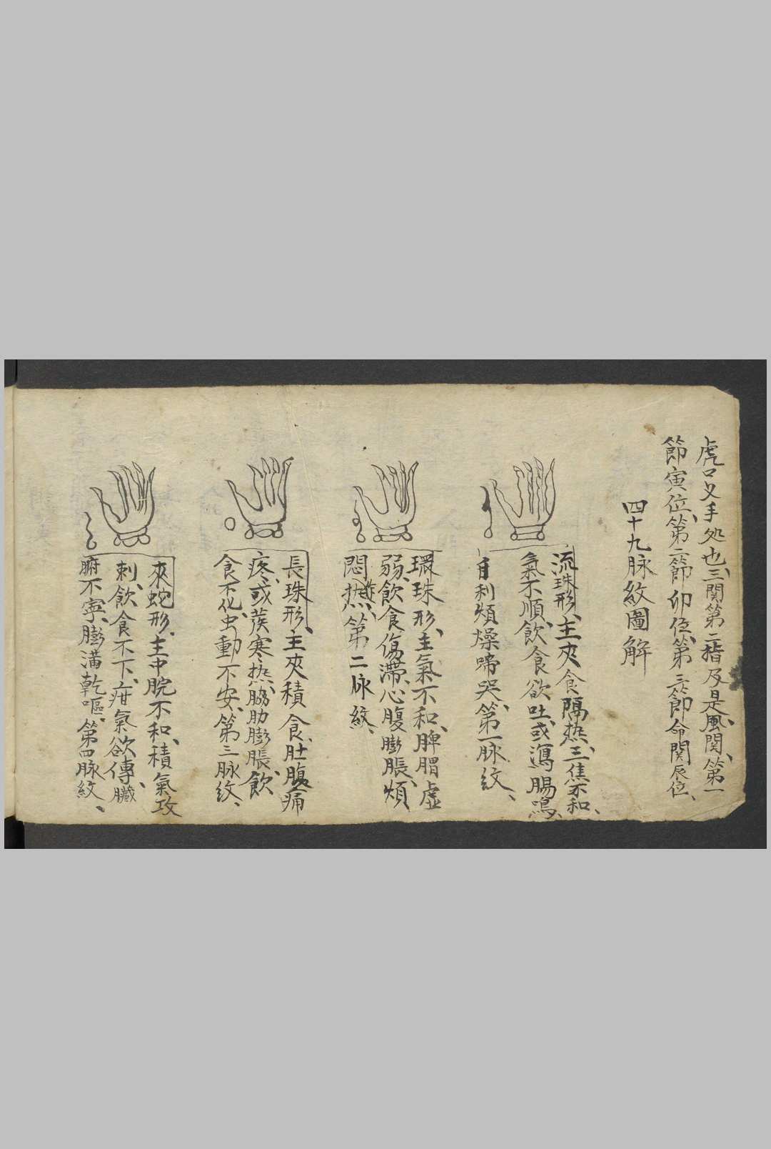 图片[8]-中华古籍网-专注古书收集熊应运 全抄小儿推拿广意 , 1900-中华古籍网-专注古书收集中华古籍网-专注古书收集
