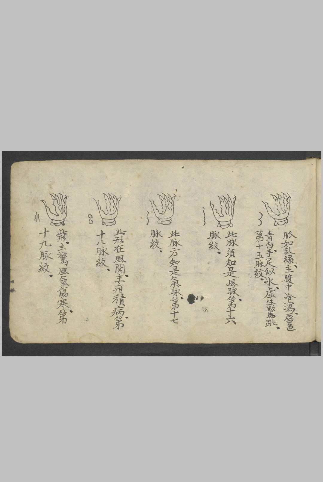 图片[4]-中华古籍网-专注古书收集熊应运 全抄小儿推拿广意 , 1900-中华古籍网-专注古书收集中华古籍网-专注古书收集