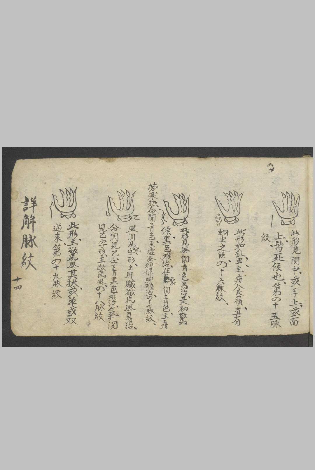 图片[13]-中华古籍网-专注古书收集熊应运 全抄小儿推拿广意 , 1900-中华古籍网-专注古书收集中华古籍网-专注古书收集