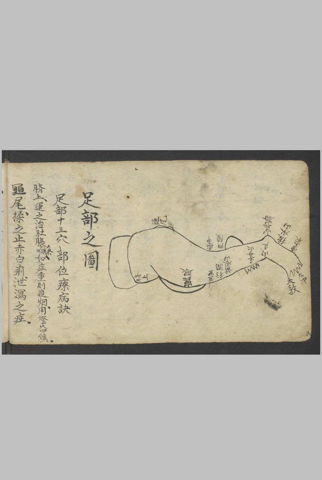 图片[14]-中华古籍网-专注古书收集熊应运 全抄小儿推拿广意 , 1900-中华古籍网-专注古书收集中华古籍网-专注古书收集