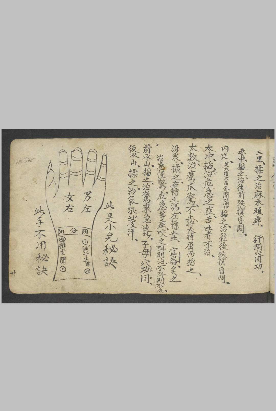 图片[21]-中华古籍网-专注古书收集熊应运 全抄小儿推拿广意 , 1900-中华古籍网-专注古书收集中华古籍网-专注古书收集