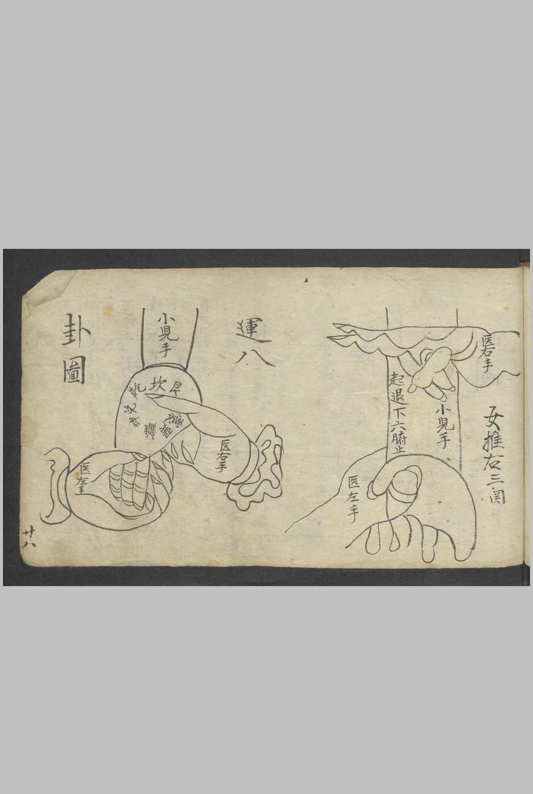 图片[20]-中华古籍网-专注古书收集熊应运 全抄小儿推拿广意 , 1900-中华古籍网-专注古书收集中华古籍网-专注古书收集