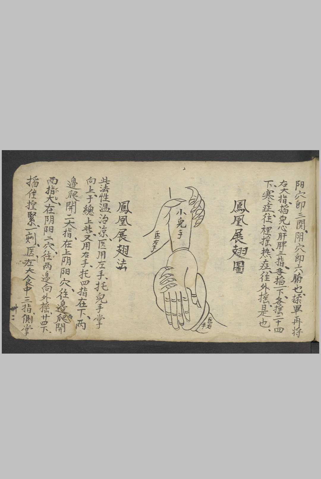 图片[17]-中华古籍网-专注古书收集熊应运 全抄小儿推拿广意 , 1900-中华古籍网-专注古书收集中华古籍网-专注古书收集