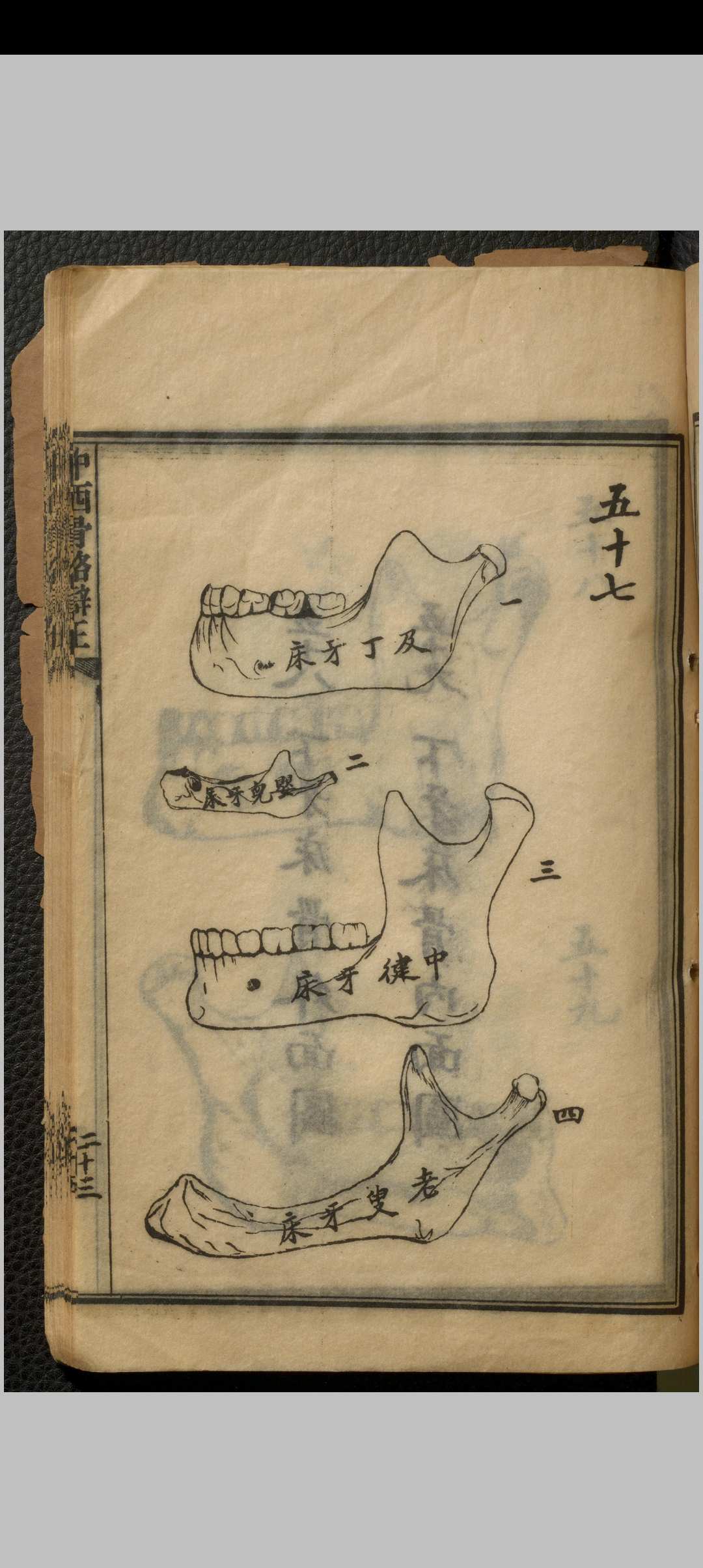 图片[13]中华古籍网-专注古书收集中西骨格辩正 七卷 刘铭之中华古籍网-专注古书收集中华古籍网