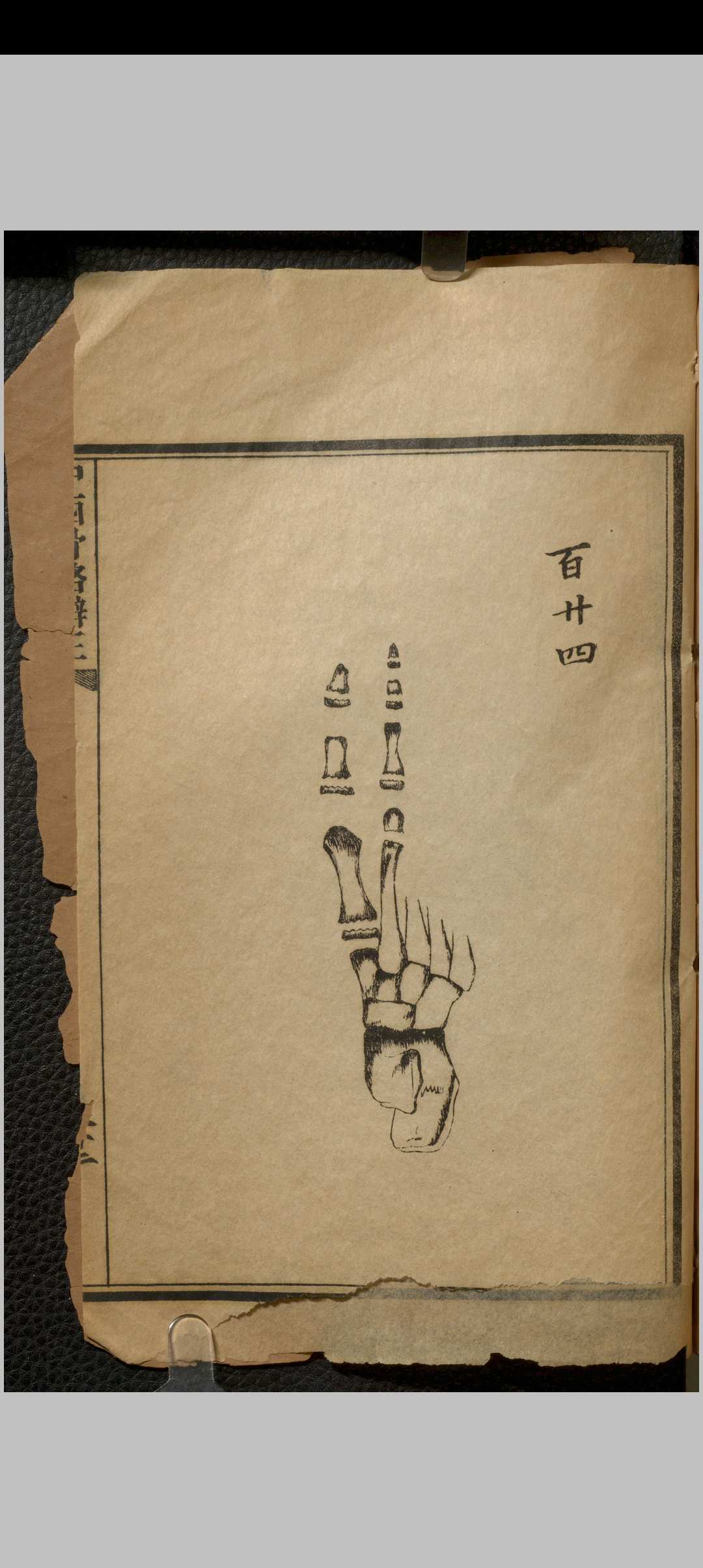 图片[12]中华古籍网-专注古书收集中西骨格辩正 七卷 刘铭之中华古籍网-专注古书收集中华古籍网