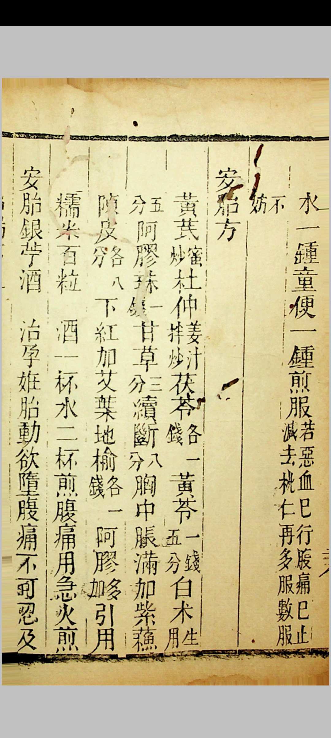 图片[16]中华古籍网-专注古书收集草亭眼科全书 胎产经验奇书全书中华古籍网-专注古书收集中华古籍网