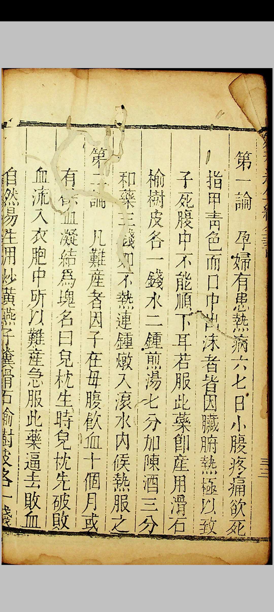 图片[10]中华古籍网-专注古书收集草亭眼科全书 胎产经验奇书全书中华古籍网-专注古书收集中华古籍网