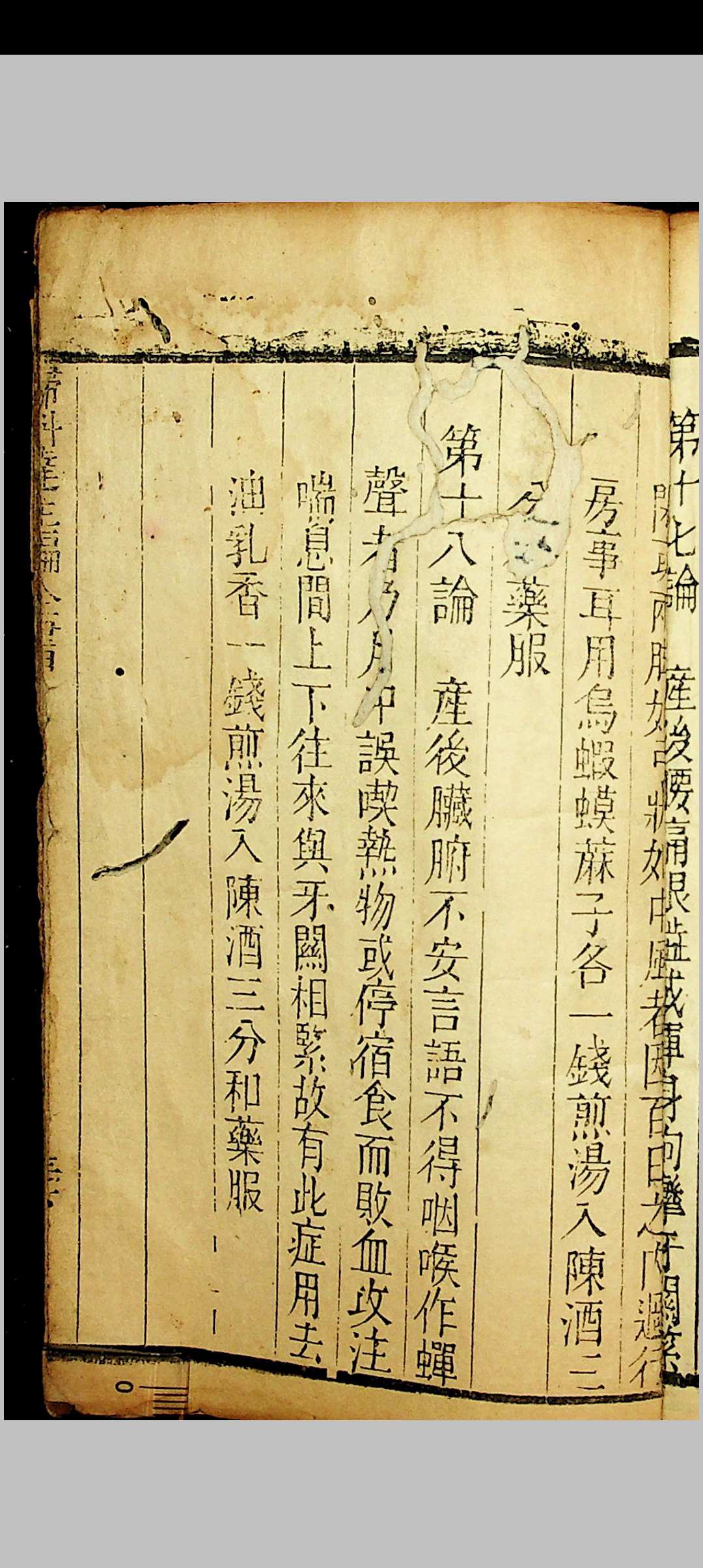 图片[19]中华古籍网-专注古书收集草亭眼科全书 胎产经验奇书全书中华古籍网-专注古书收集中华古籍网