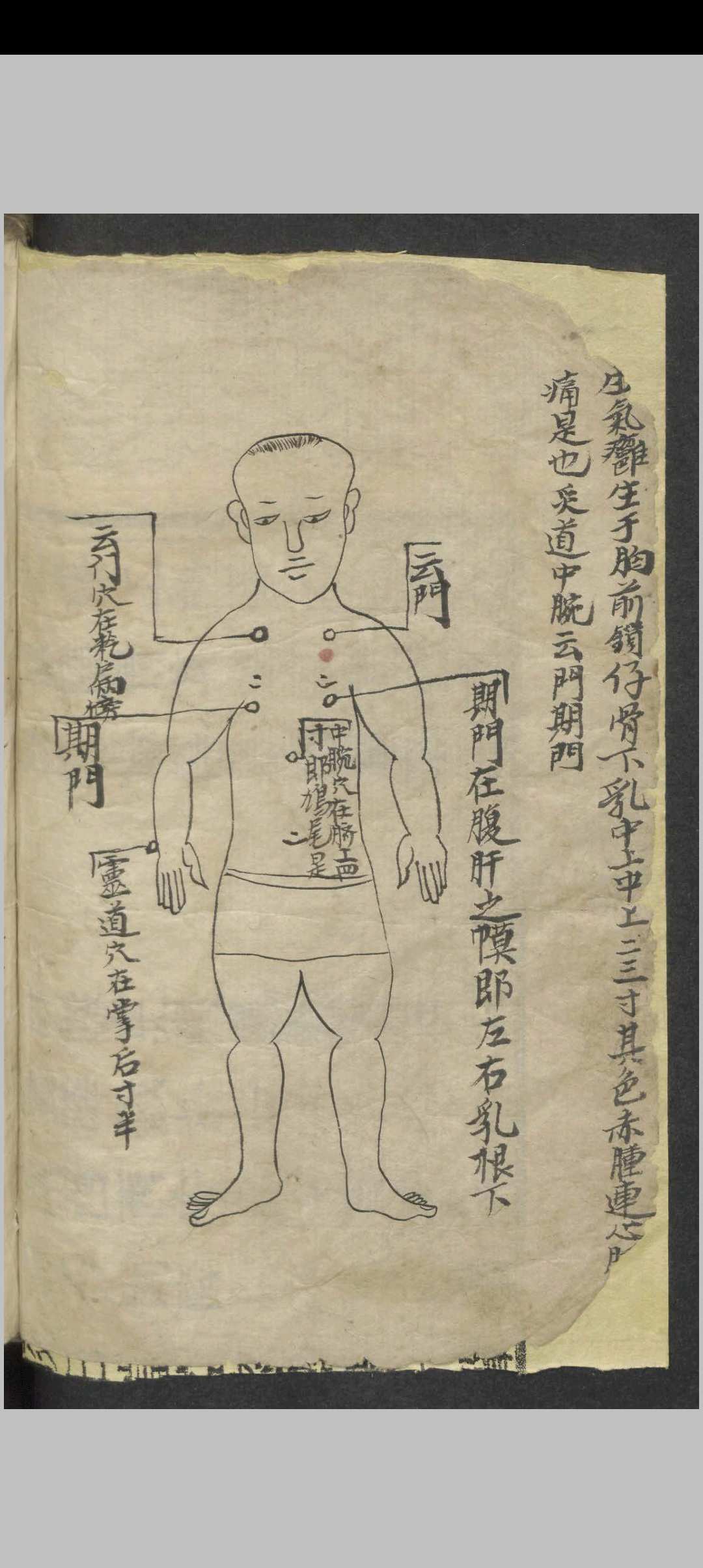 图片[2]-中华古籍网-专注古书收集百症图说 , 1900-中华古籍网-专注古书收集中华古籍网-专注古书收集