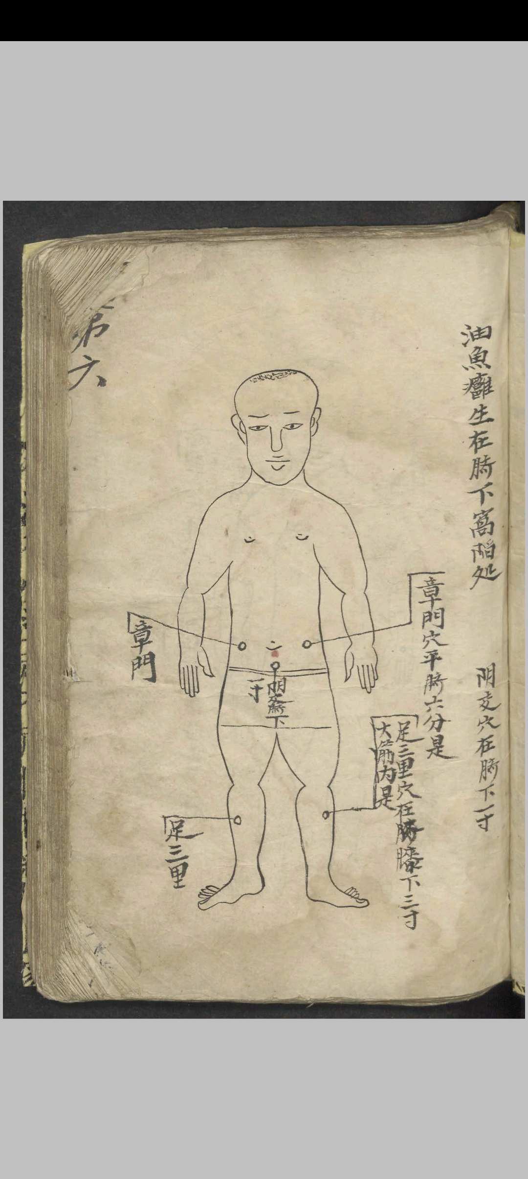 图片[5]-中华古籍网-专注古书收集百症图说 , 1900-中华古籍网-专注古书收集中华古籍网-专注古书收集