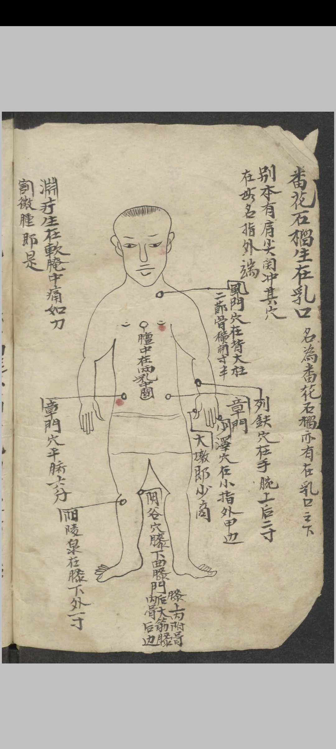 图片[10]-中华古籍网-专注古书收集百症图说 , 1900-中华古籍网-专注古书收集中华古籍网-专注古书收集