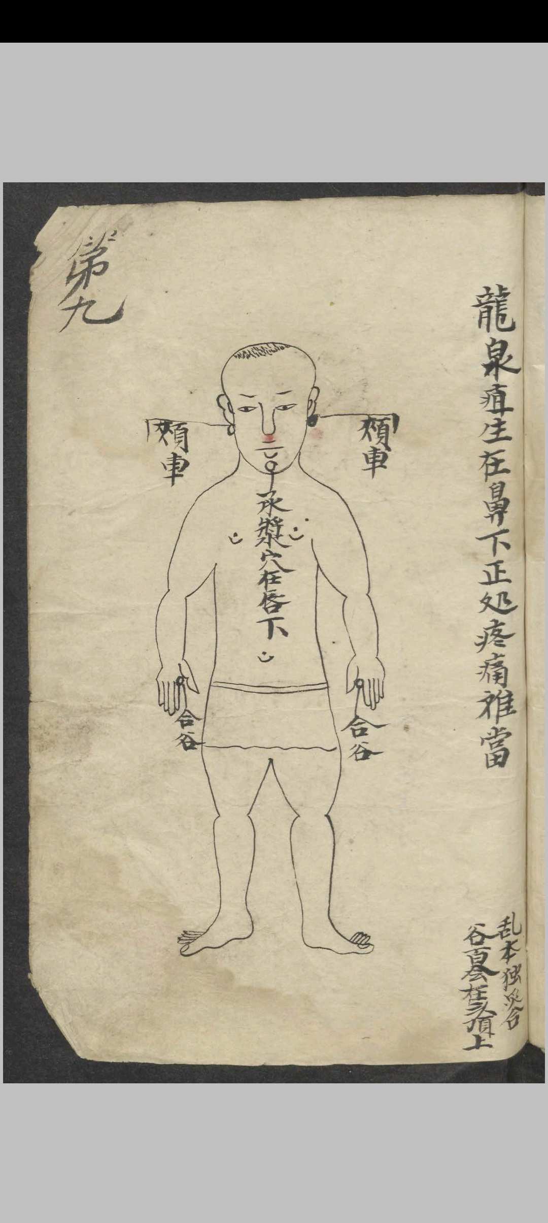 图片[8]-中华古籍网-专注古书收集百症图说 , 1900-中华古籍网-专注古书收集中华古籍网-专注古书收集