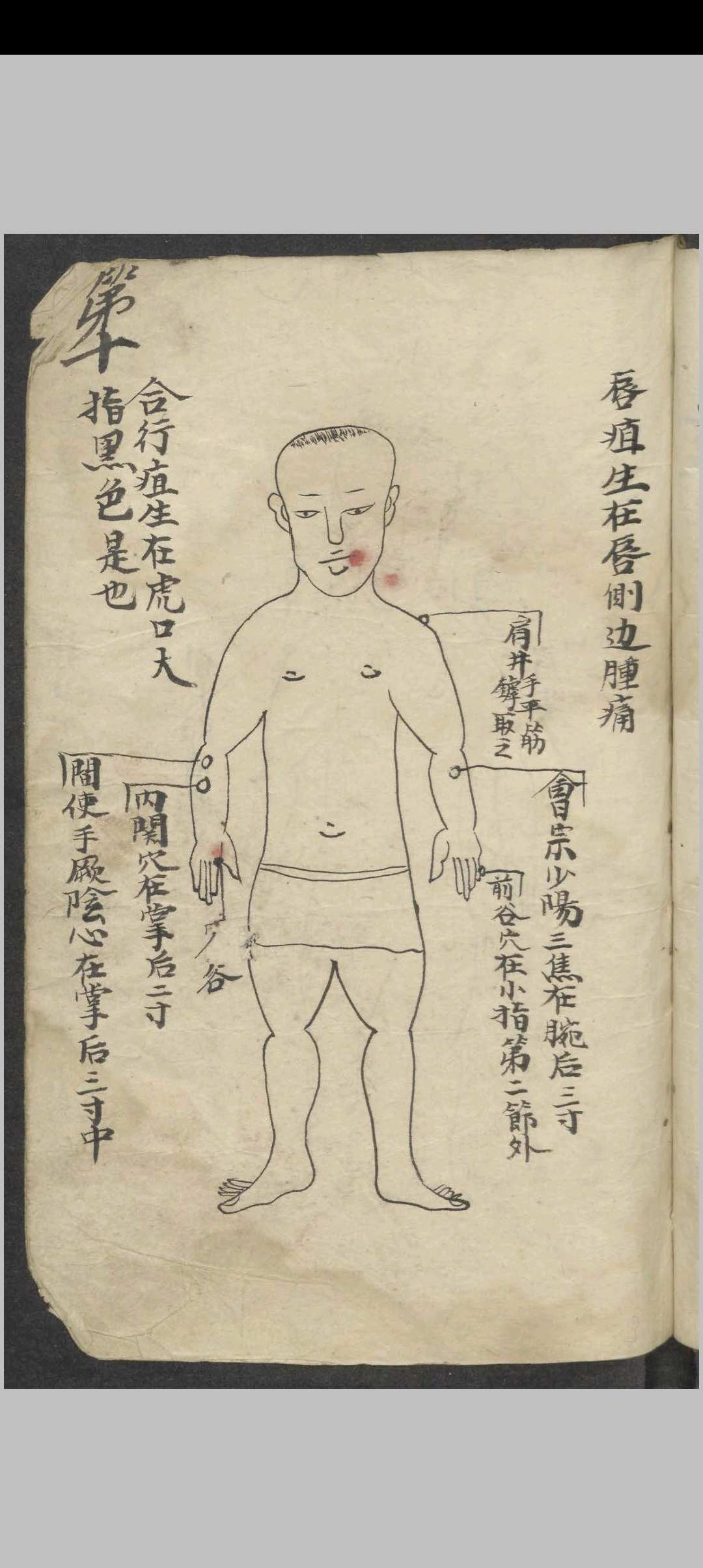 图片[11]-中华古籍网-专注古书收集百症图说 , 1900-中华古籍网-专注古书收集中华古籍网-专注古书收集