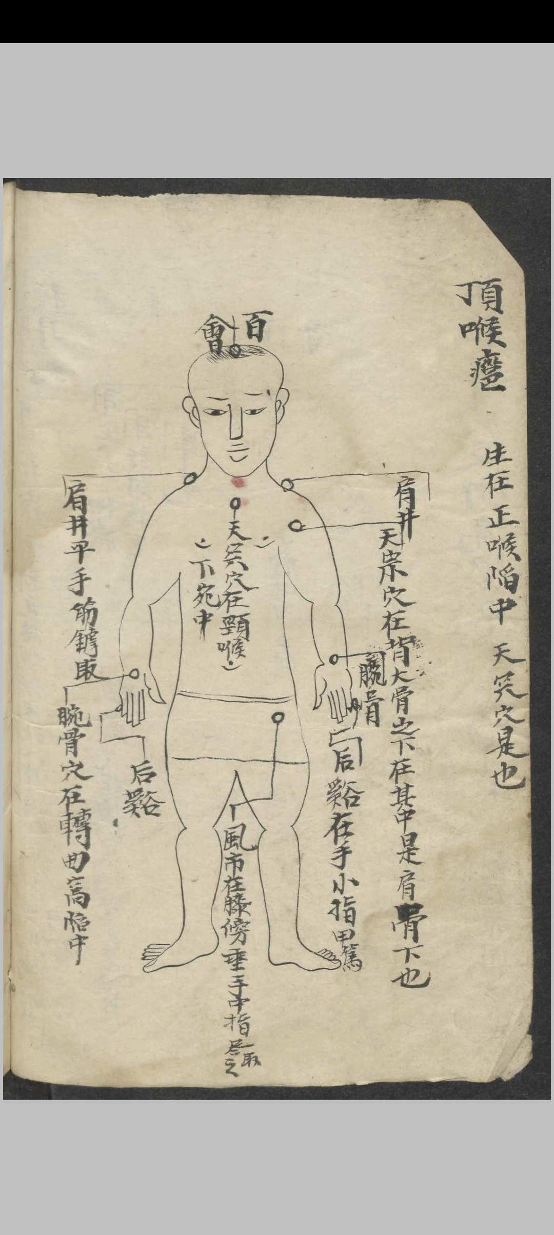 图片[12]-中华古籍网-专注古书收集百症图说 , 1900-中华古籍网-专注古书收集中华古籍网-专注古书收集