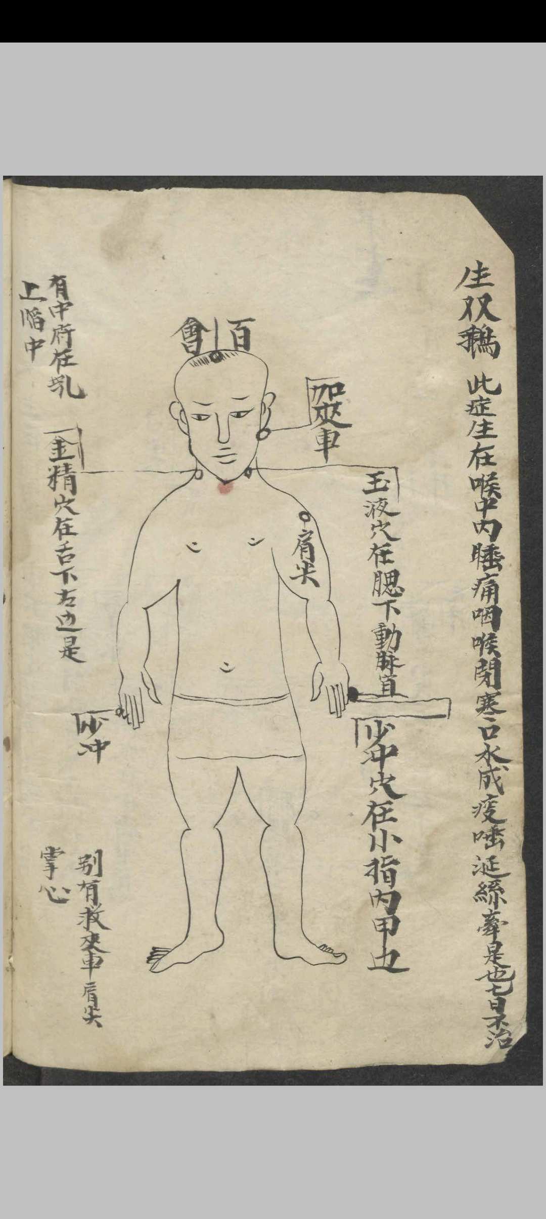 图片[9]-中华古籍网-专注古书收集百症图说 , 1900-中华古籍网-专注古书收集中华古籍网-专注古书收集