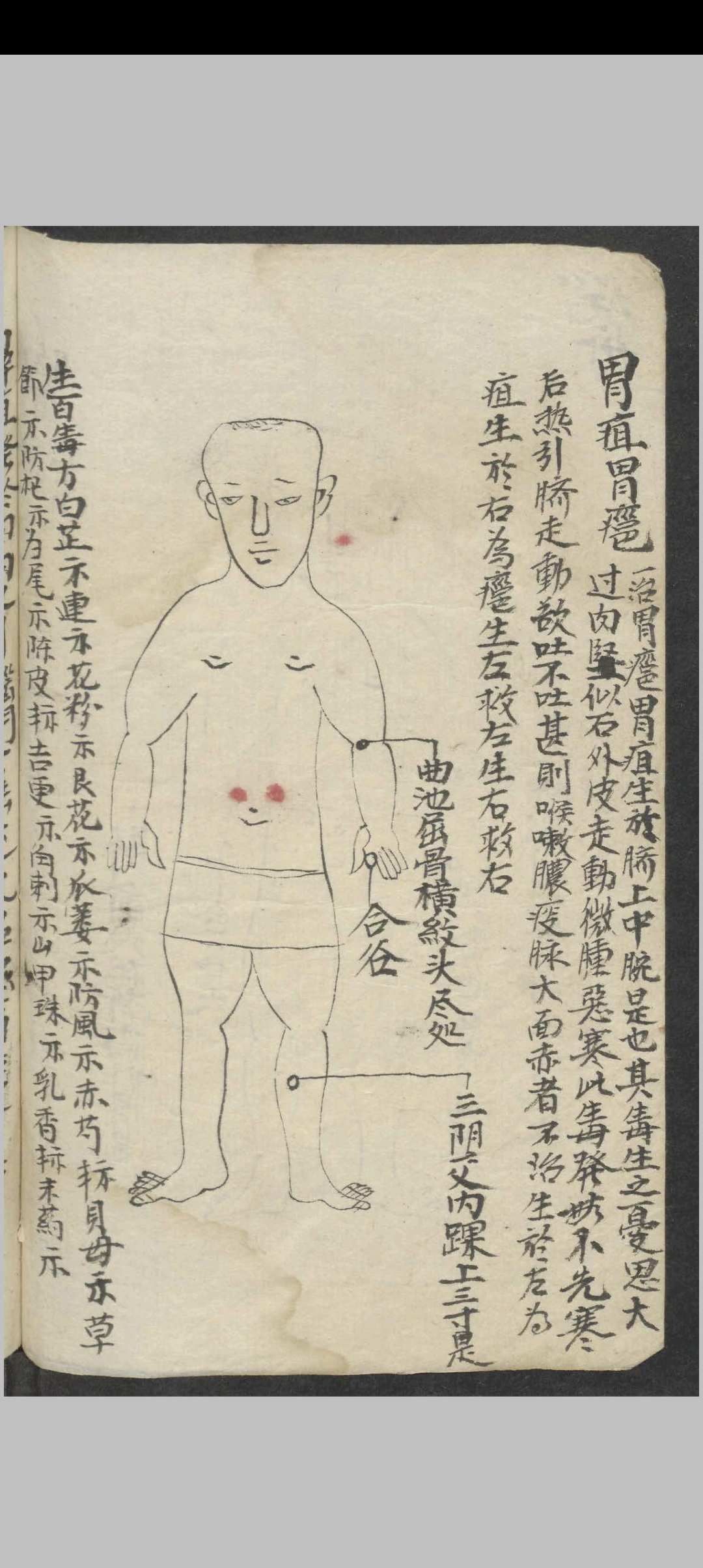 图片[3]-中华古籍网-专注古书收集百症图说 , 1900-中华古籍网-专注古书收集中华古籍网-专注古书收集