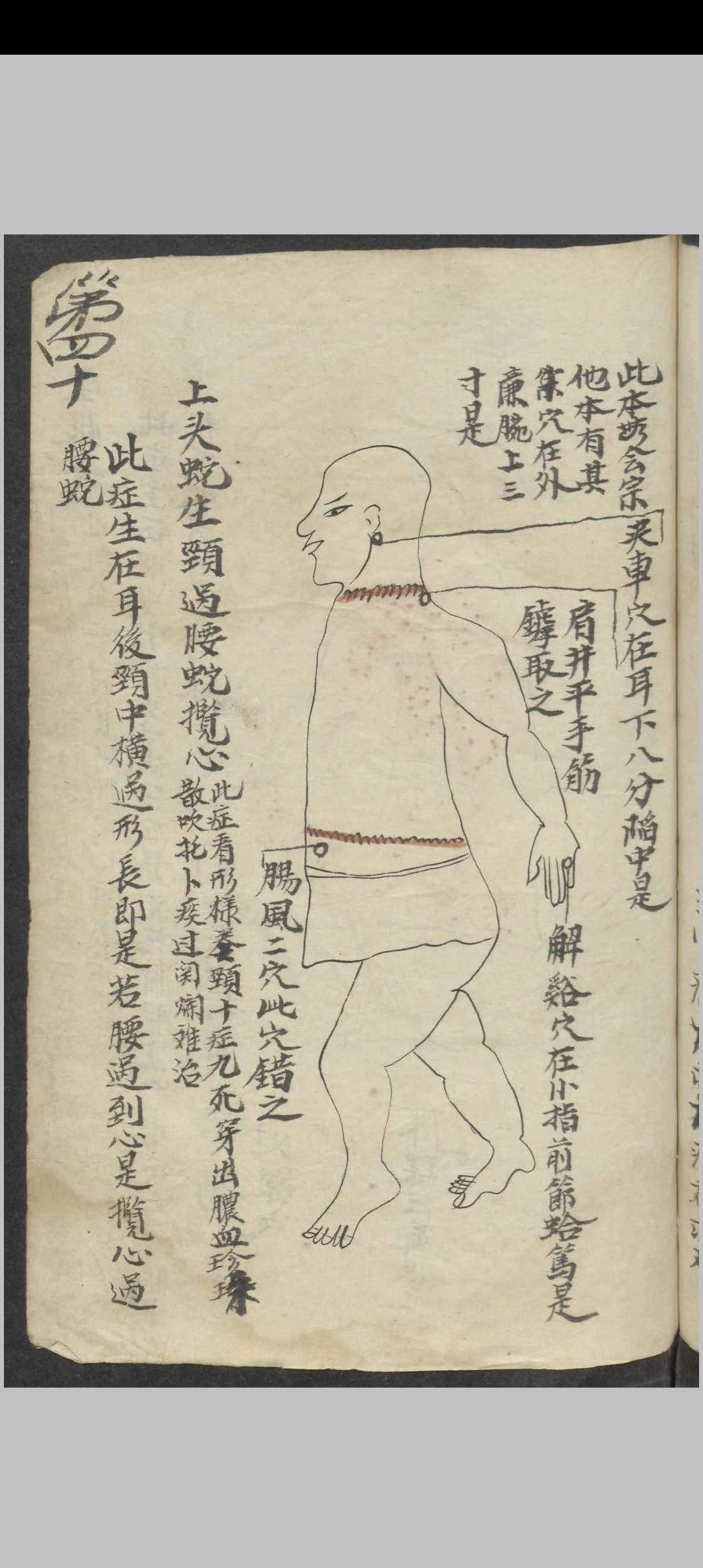 图片[6]-中华古籍网-专注古书收集百症图说 , 1900-中华古籍网-专注古书收集中华古籍网-专注古书收集