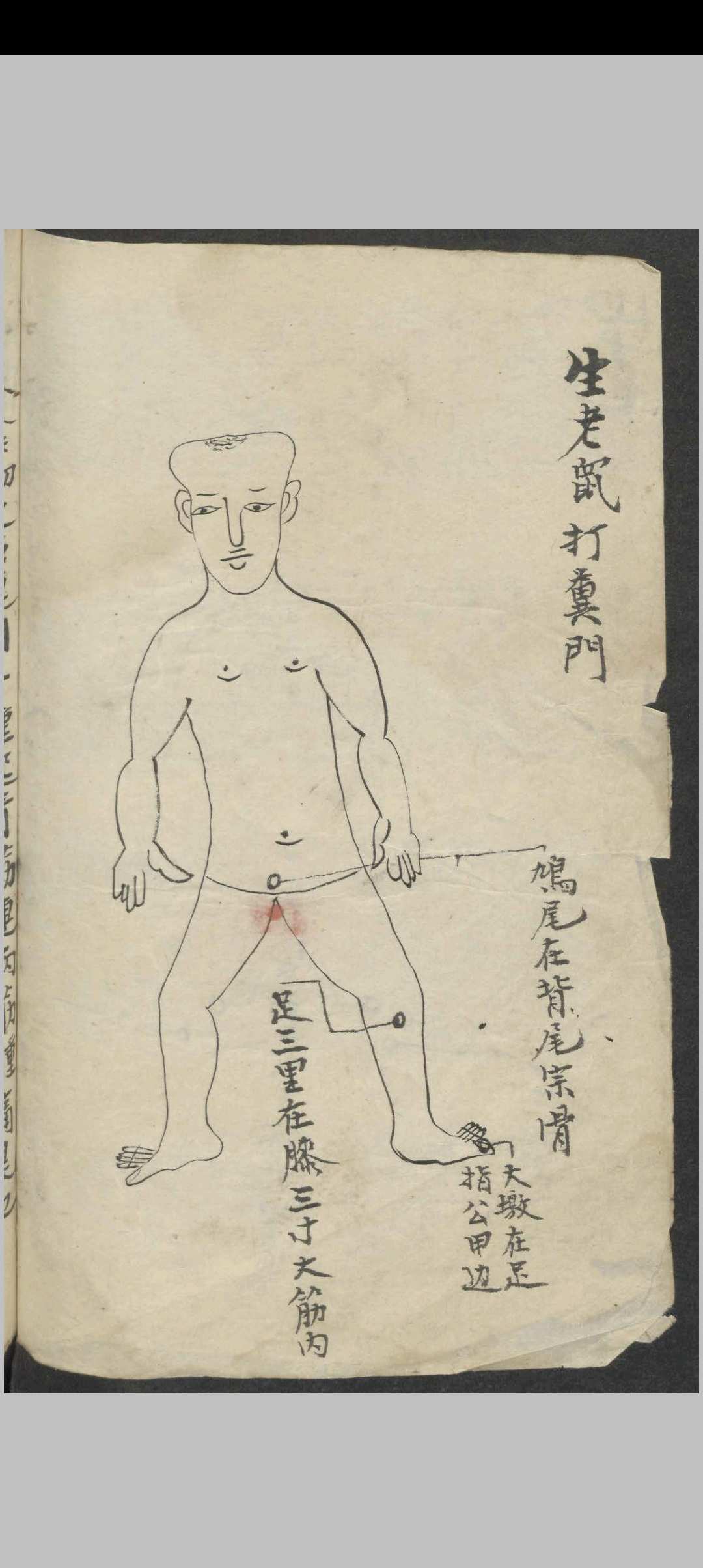图片[4]-中华古籍网-专注古书收集百症图说 , 1900-中华古籍网-专注古书收集中华古籍网-专注古书收集