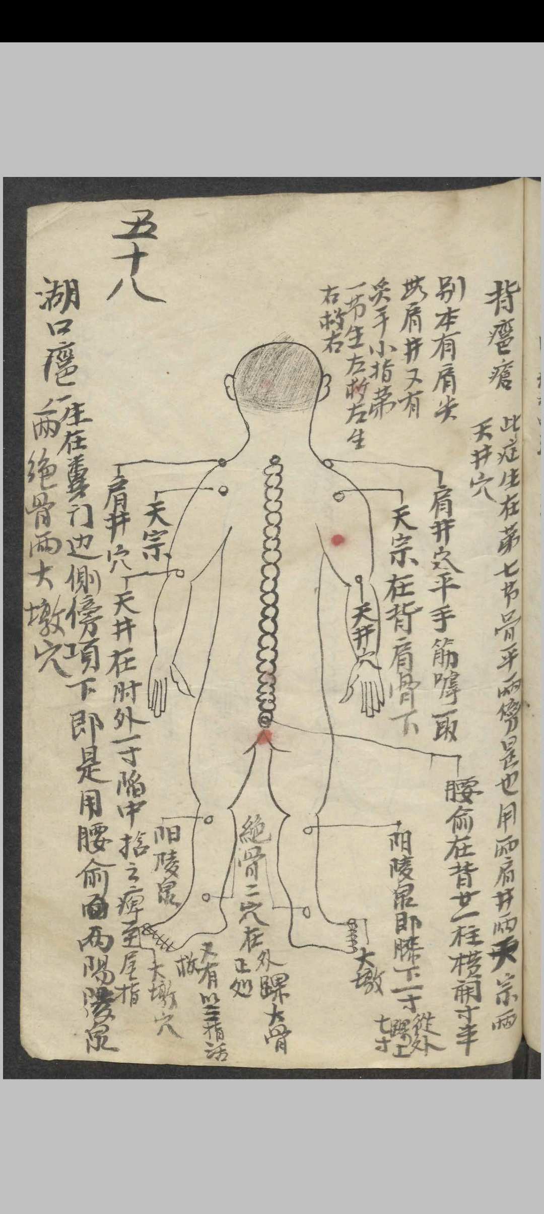 图片[13]-中华古籍网-专注古书收集百症图说 , 1900-中华古籍网-专注古书收集中华古籍网-专注古书收集
