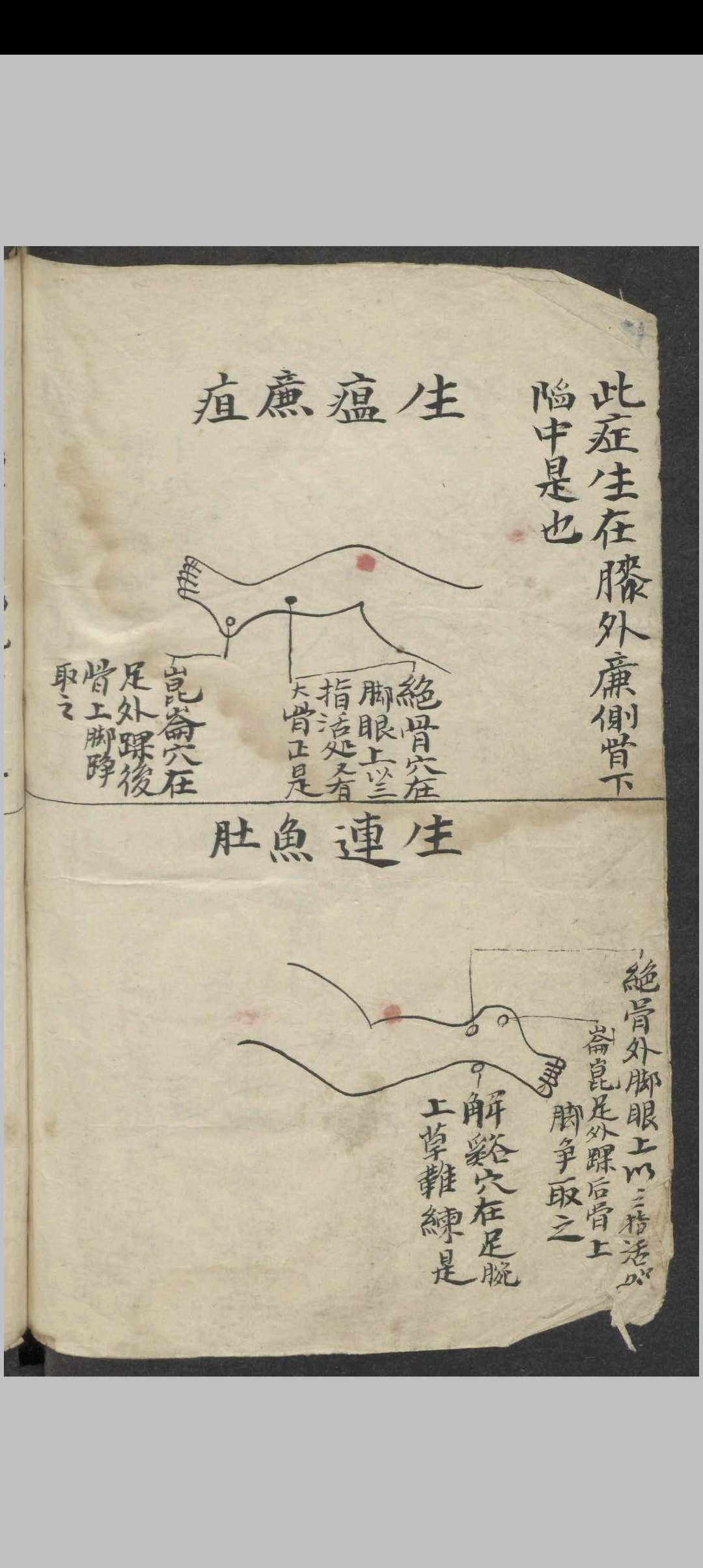 图片[14]-中华古籍网-专注古书收集百症图说 , 1900-中华古籍网-专注古书收集中华古籍网-专注古书收集