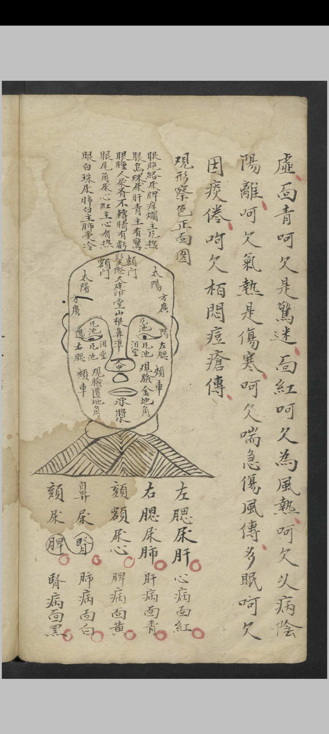 图片[8]-中华古籍网-专注古书收集惊风杂症 , 1800-中华古籍网-专注古书收集中华古籍网-专注古书收集