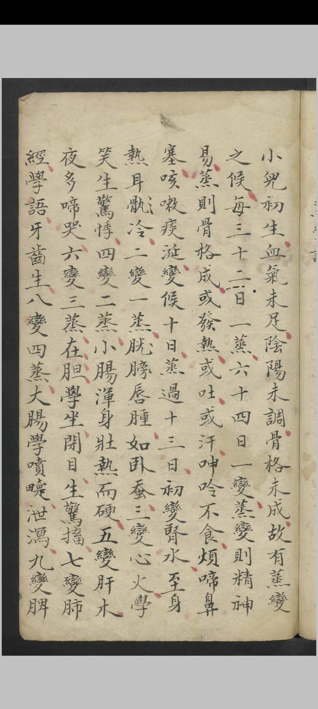 图片[4]-中华古籍网-专注古书收集惊风杂症 , 1800-中华古籍网-专注古书收集中华古籍网-专注古书收集