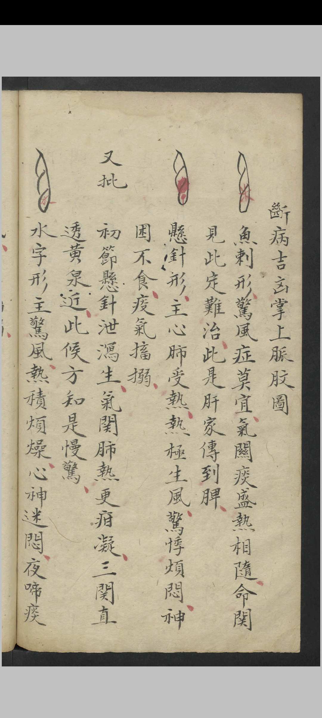 图片[13]-中华古籍网-专注古书收集惊风杂症 , 1800-中华古籍网-专注古书收集中华古籍网-专注古书收集
