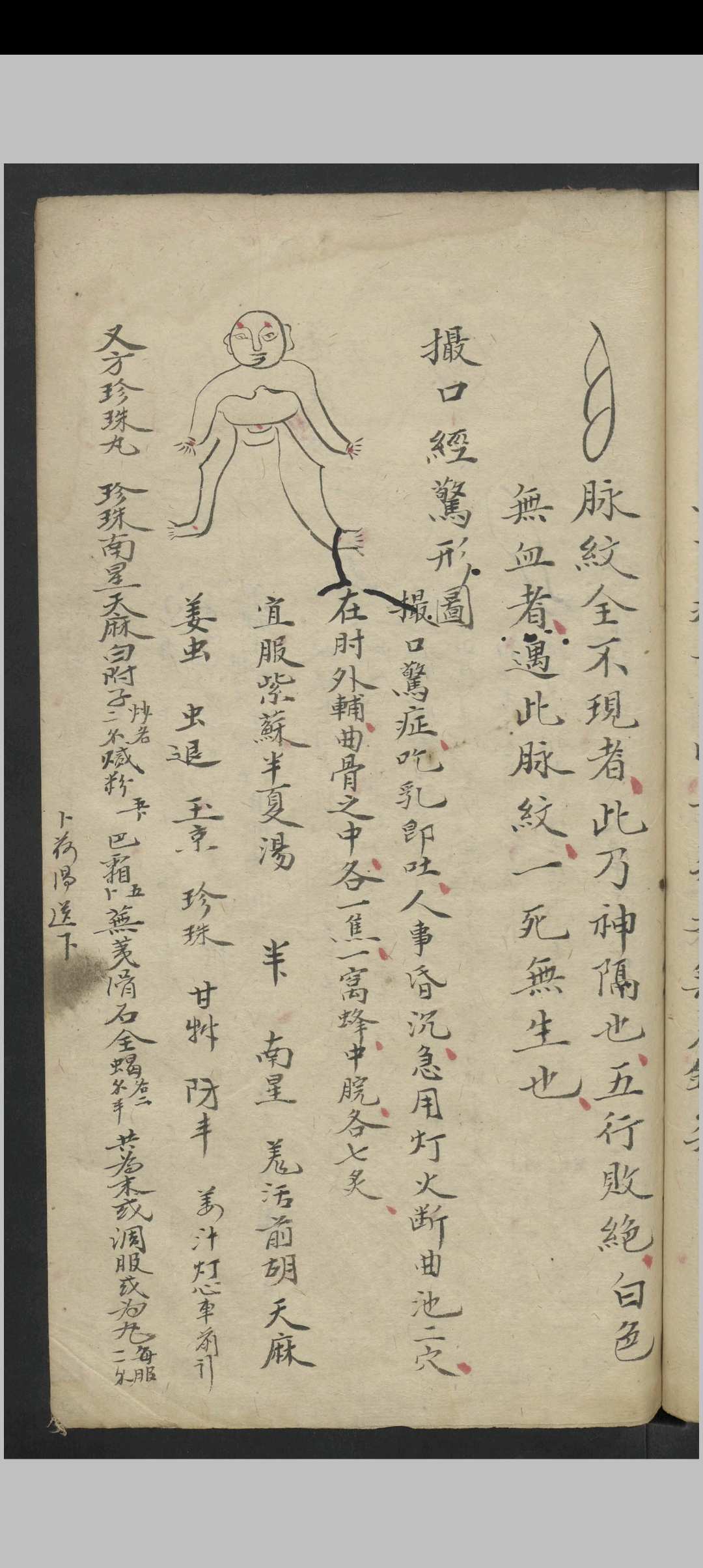 图片[10]-中华古籍网-专注古书收集惊风杂症 , 1800-中华古籍网-专注古书收集中华古籍网-专注古书收集