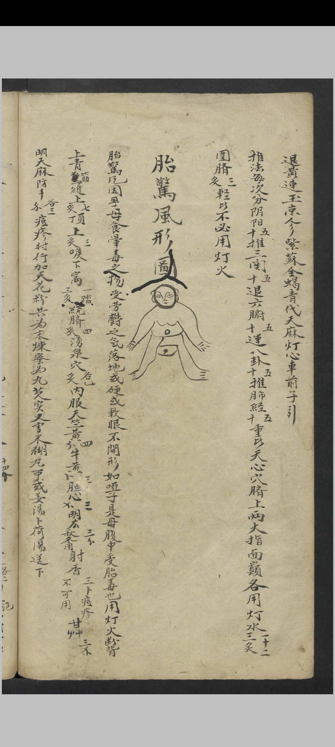 图片[21]-中华古籍网-专注古书收集惊风杂症 , 1800-中华古籍网-专注古书收集中华古籍网-专注古书收集