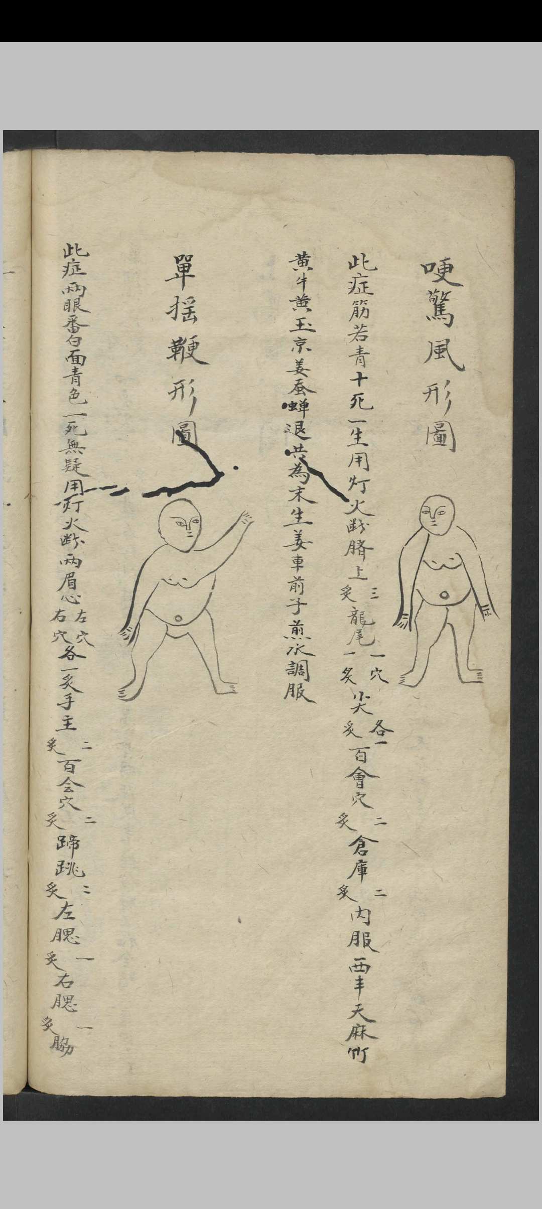 图片[20]-中华古籍网-专注古书收集惊风杂症 , 1800-中华古籍网-专注古书收集中华古籍网-专注古书收集