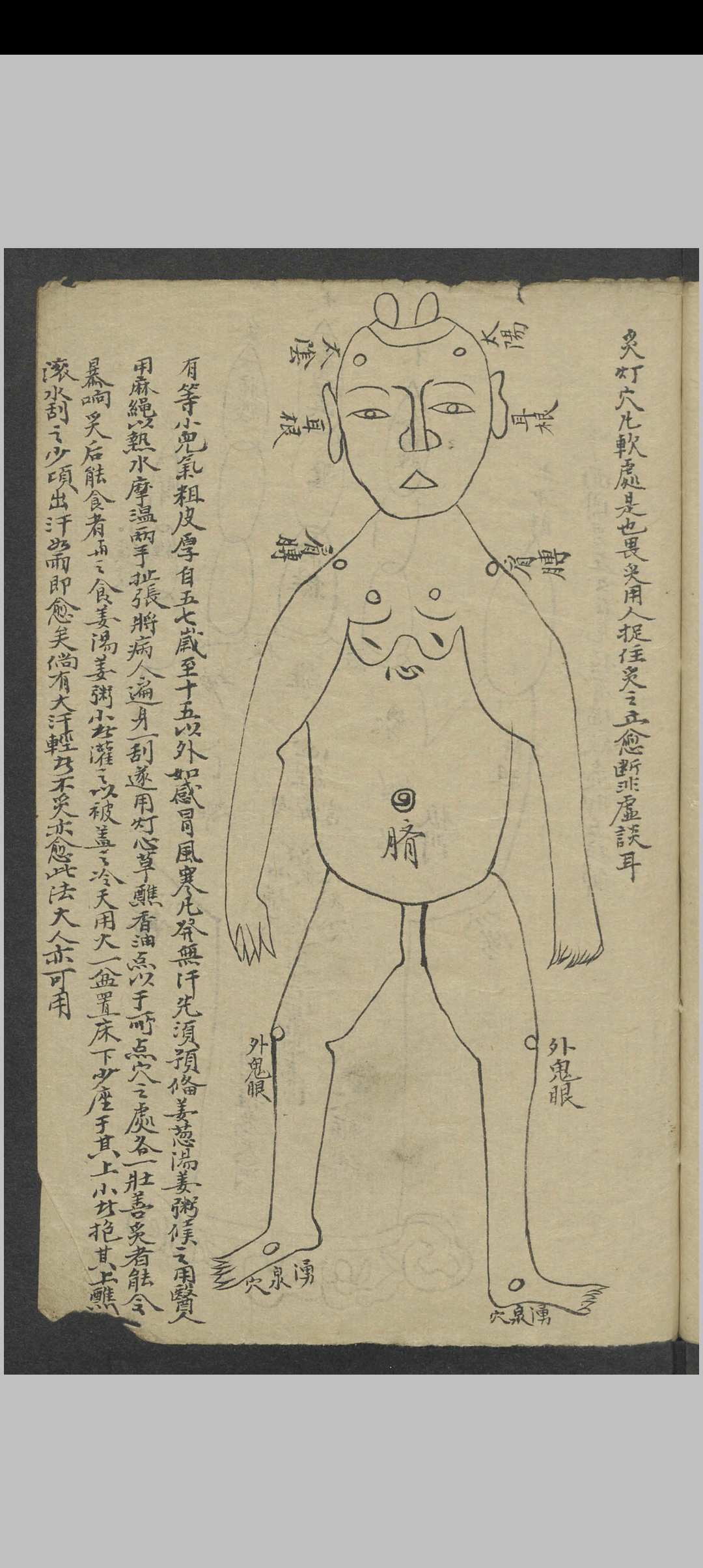 图片[5]-中华古籍网-专注古书收集小儿推拿 , 1900-中华古籍网-专注古书收集中华古籍网-专注古书收集