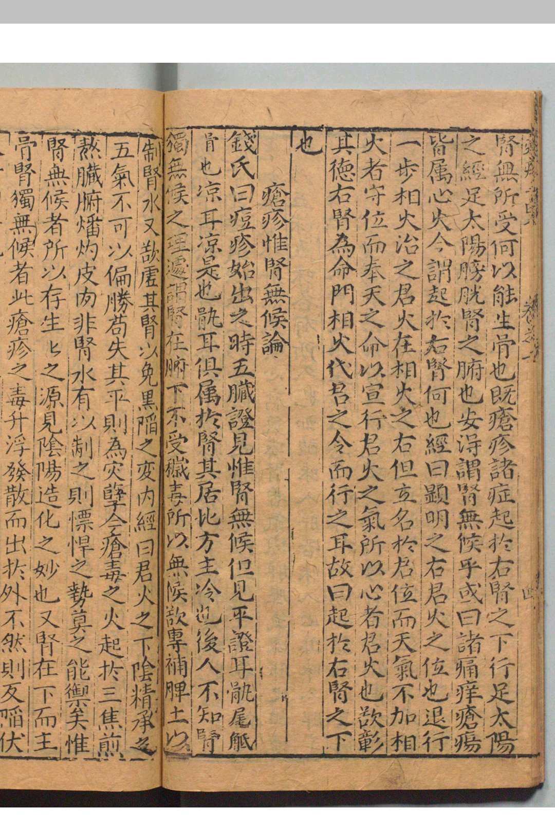 图片[5]中华古籍网-专注古书收集痘疹一览 阴有澜 明刊本中华古籍网-专注古书收集中华古籍网