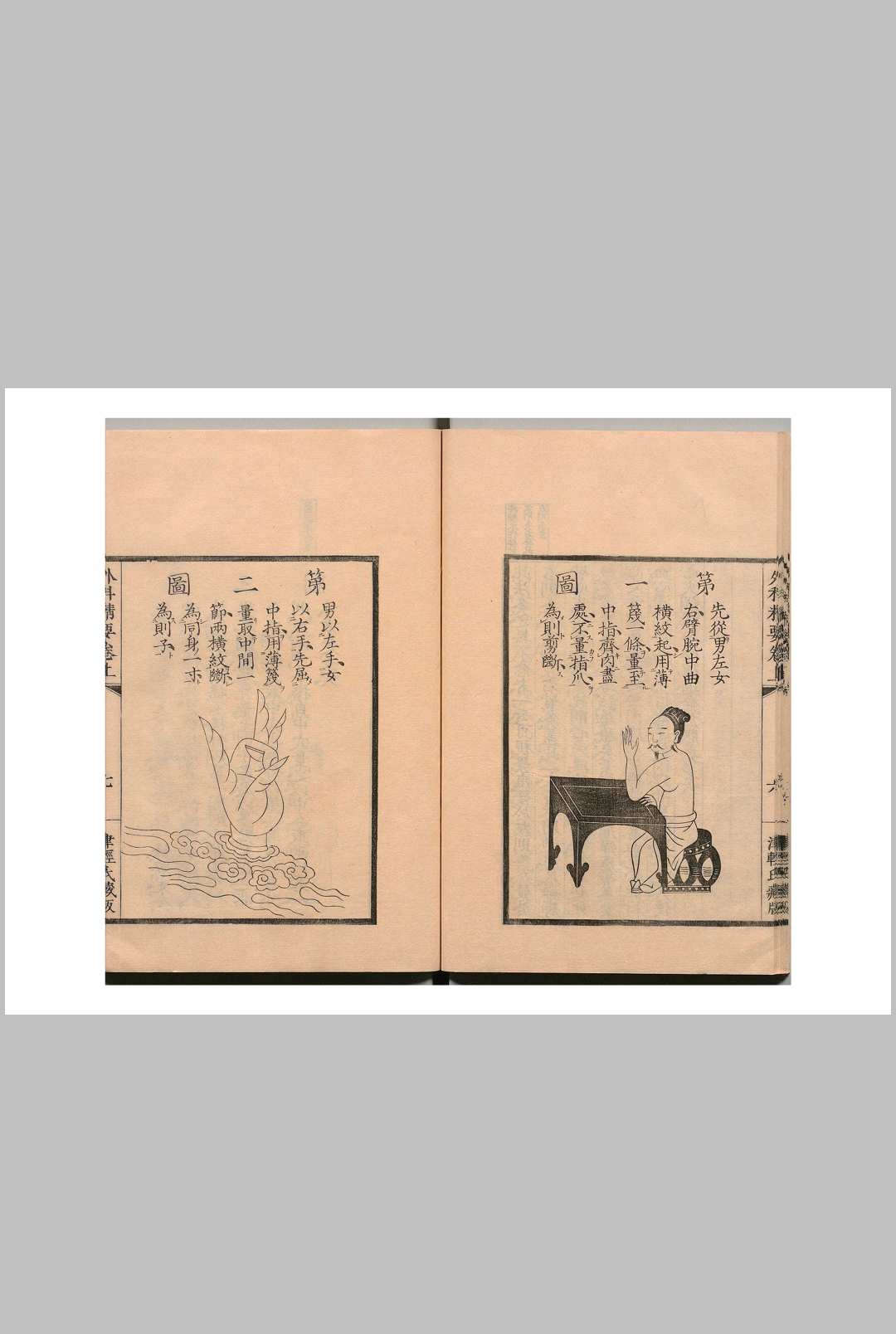 图片[9]中华古籍网-专注古书收集外科精要 陈自明  宋中华古籍网-专注古书收集中华古籍网