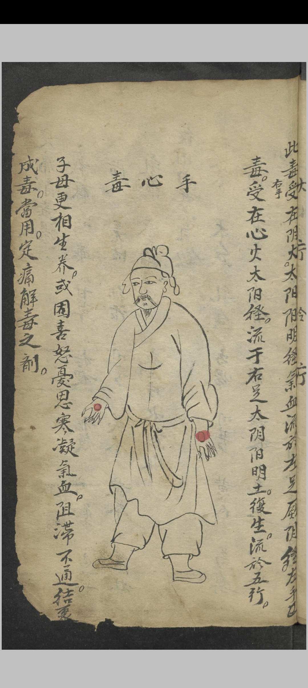 图片[5]-中华古籍网-专注古书收集窦杰 窦杰 窦太师疮疡经验全书-中华古籍网-专注古书收集中华古籍网-专注古书收集