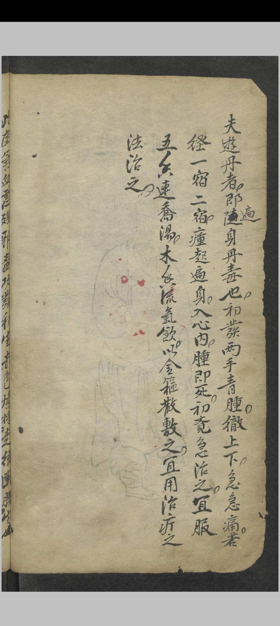 图片[8]-中华古籍网-专注古书收集窦杰 窦杰 窦太师疮疡经验全书-中华古籍网-专注古书收集中华古籍网-专注古书收集