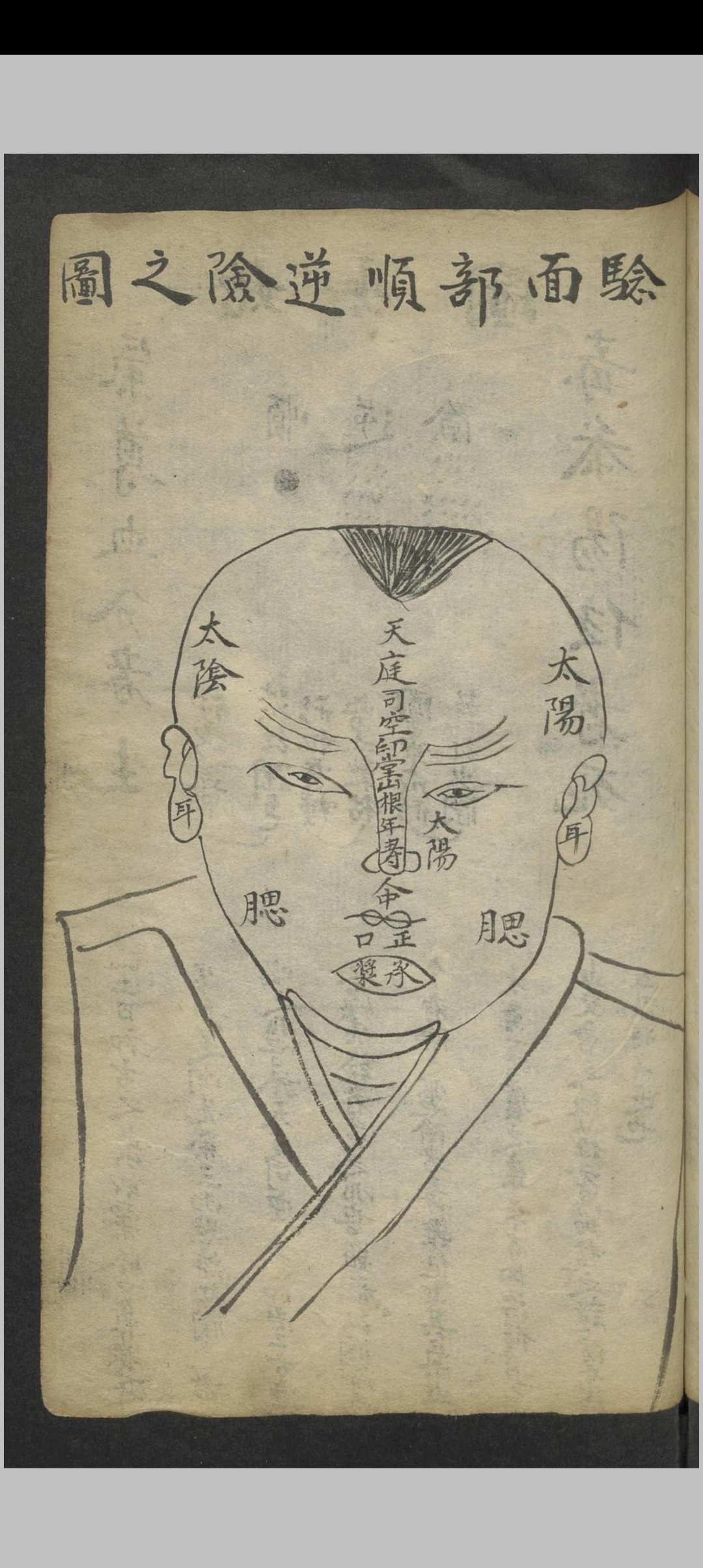 图片[16]-中华古籍网-专注古书收集窦杰 窦杰 窦太师疮疡经验全书-中华古籍网-专注古书收集中华古籍网-专注古书收集
