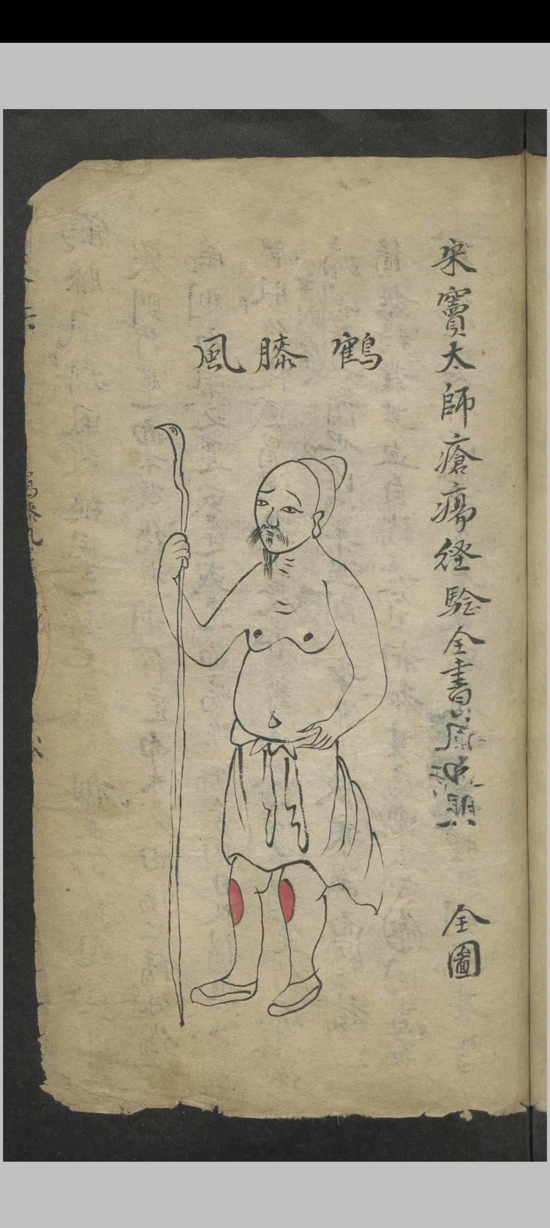 图片[17]-中华古籍网-专注古书收集窦杰 窦杰 窦太师疮疡经验全书-中华古籍网-专注古书收集中华古籍网-专注古书收集