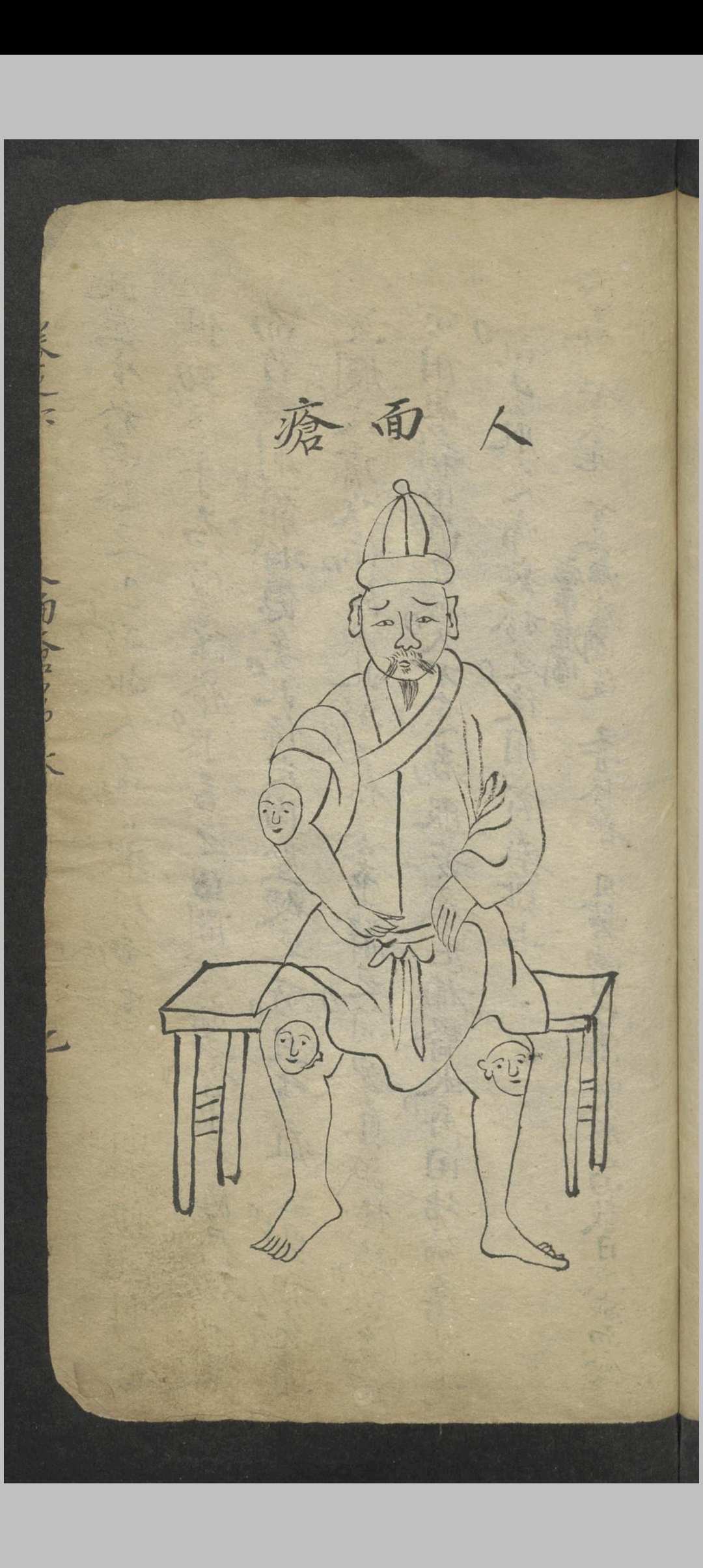 图片[15]-中华古籍网-专注古书收集窦杰 窦杰 窦太师疮疡经验全书-中华古籍网-专注古书收集中华古籍网-专注古书收集