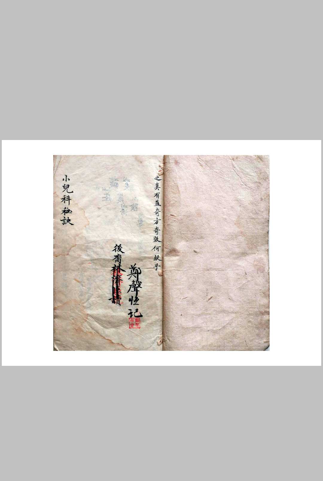 图片[2]-中华古籍网-专注古书收集《祖传小儿科神火经纹秘诀》-中华古籍网-专注古书收集中华古籍网-专注古书收集