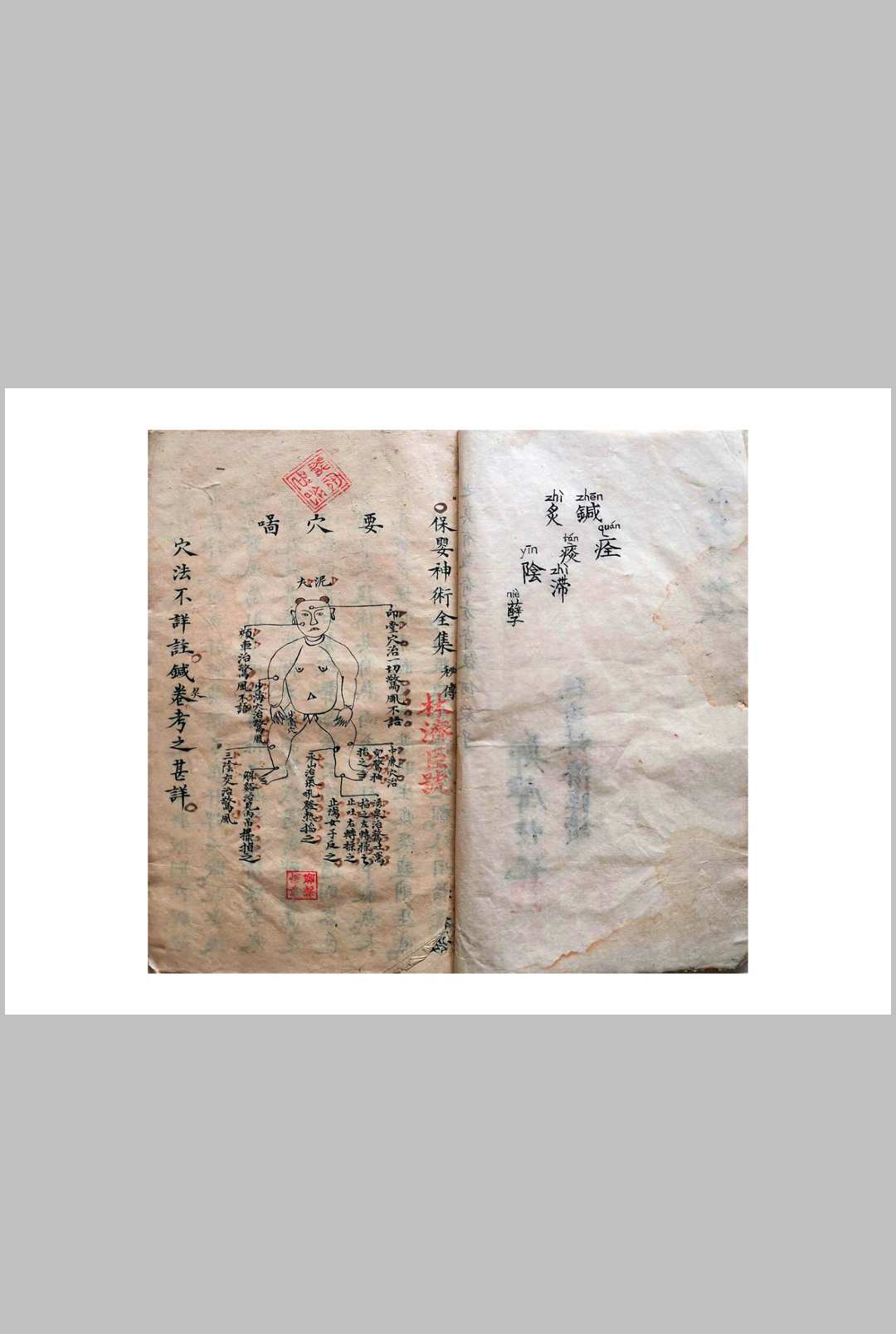 图片[3]-中华古籍网-专注古书收集《祖传小儿科神火经纹秘诀》-中华古籍网-专注古书收集中华古籍网-专注古书收集