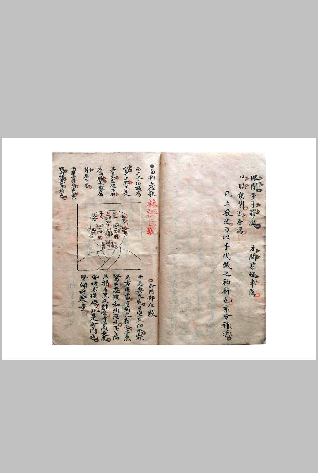 图片[14]-中华古籍网-专注古书收集《祖传小儿科神火经纹秘诀》-中华古籍网-专注古书收集中华古籍网-专注古书收集