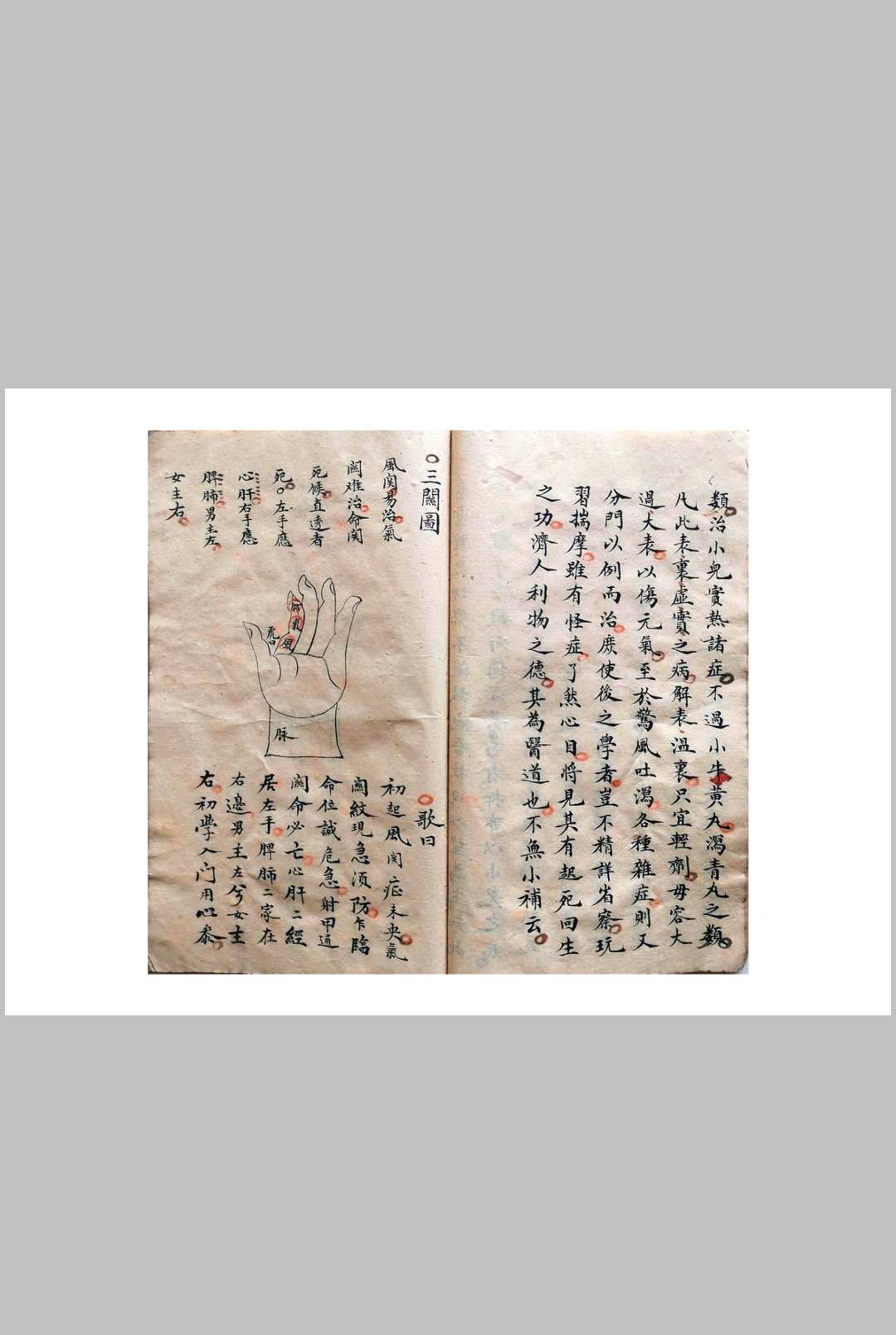 图片[5]-中华古籍网-专注古书收集《祖传小儿科神火经纹秘诀》-中华古籍网-专注古书收集中华古籍网-专注古书收集