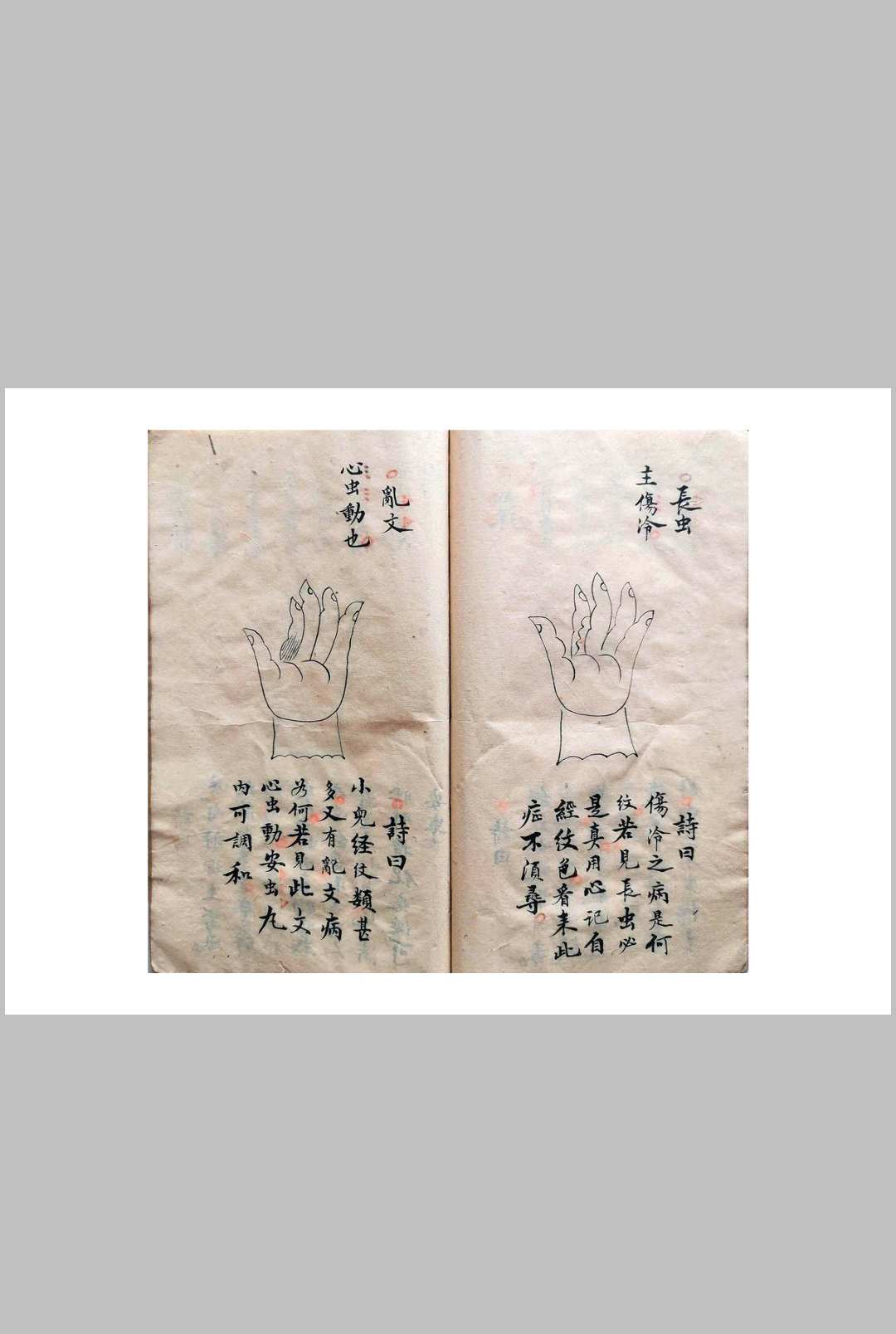 图片[15]-中华古籍网-专注古书收集《祖传小儿科神火经纹秘诀》-中华古籍网-专注古书收集中华古籍网-专注古书收集